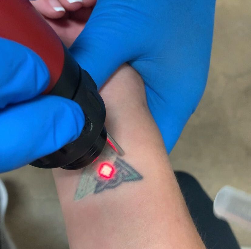 Rethink Your Ink Laser Tattoo Removal - Home